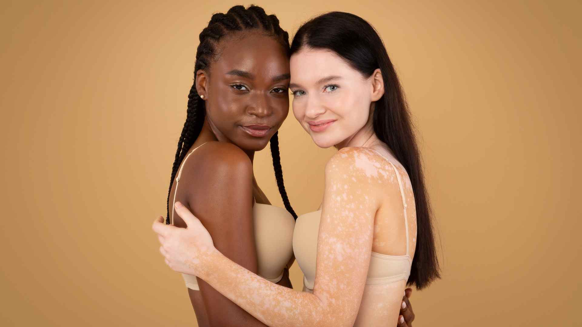 bielactwo dwie kobiety w uścisku amvi cosmetics