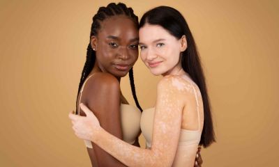 bielactwo dwie kobiety w uścisku amvi cosmetics